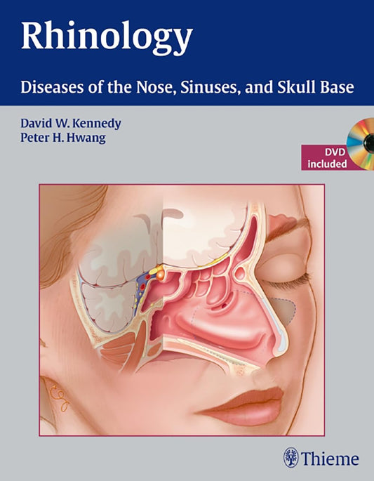 RHINOLOGY DISEASE OF THE NOSE SINUSES AND SKULL BASE - DAVID KENNEDY