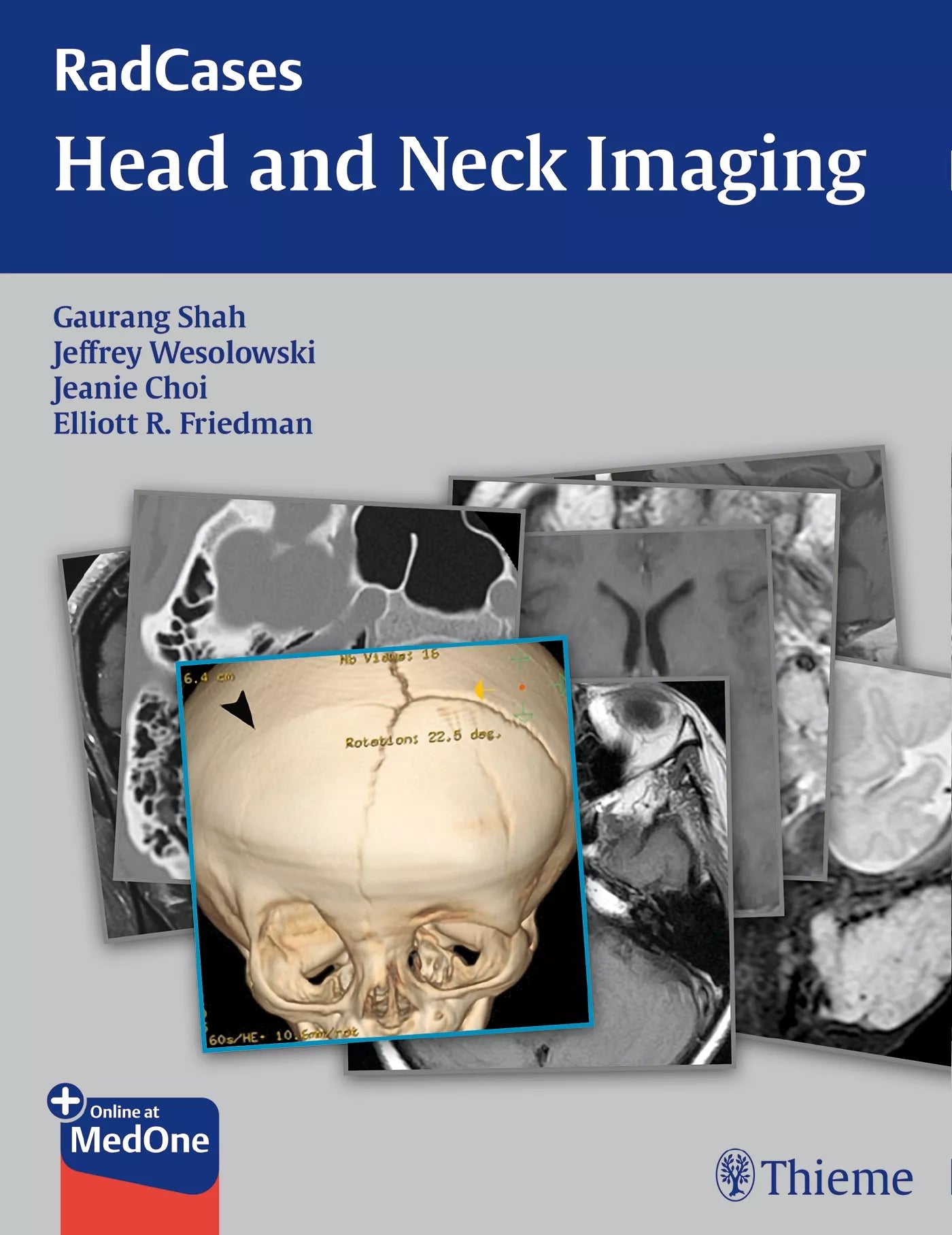 Head and Neck Imaging : Radcases 1ST/2016