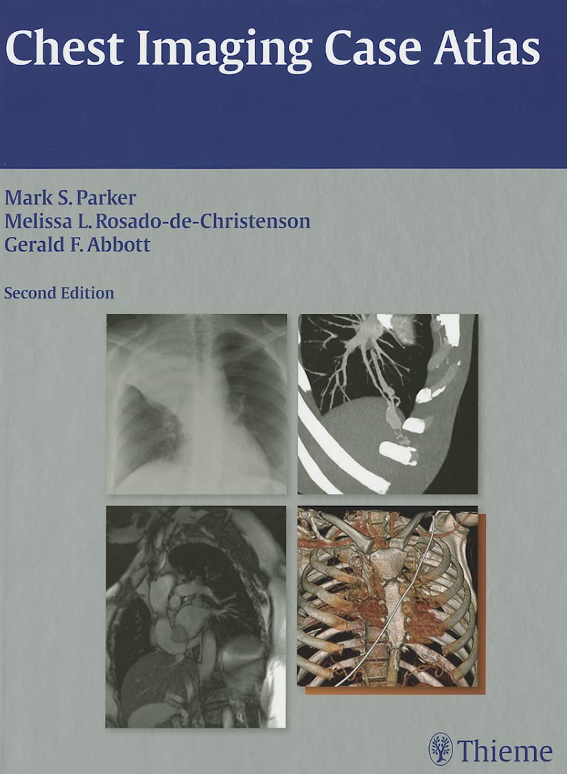 CHEST IMAGING CASE ATLAS VOLUME:1 2ND/2012 - MARK PARKER