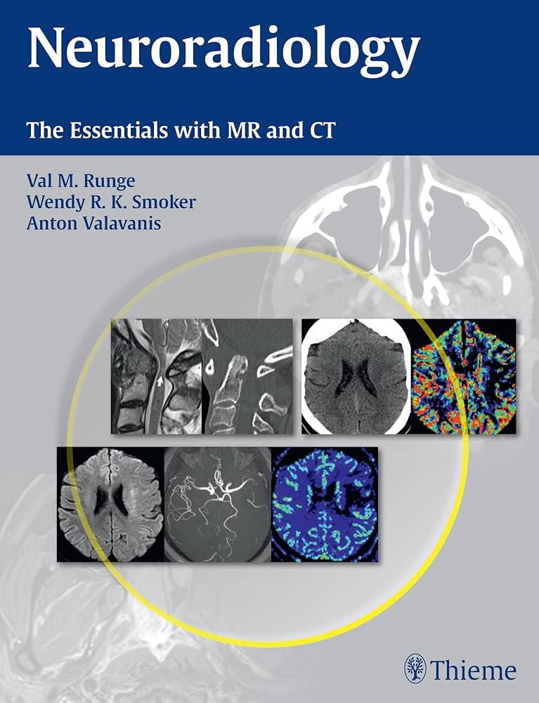 Neuroradiology: The Essentials with MR and CT 1E/2015