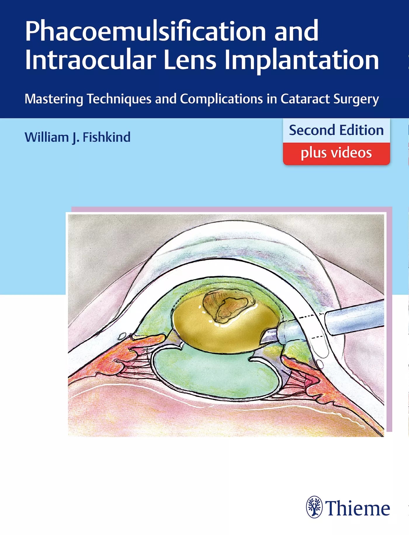 PHACOEMULSIFICATION AND INTRAOCULAR LENS IMPLANTATION 2E/2017