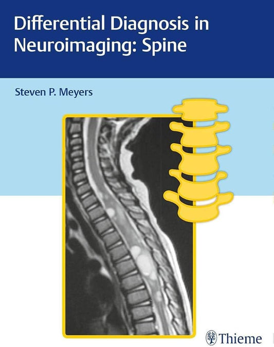 Differential Diagnosis in Neuroimaging: Spine 1ST/2016