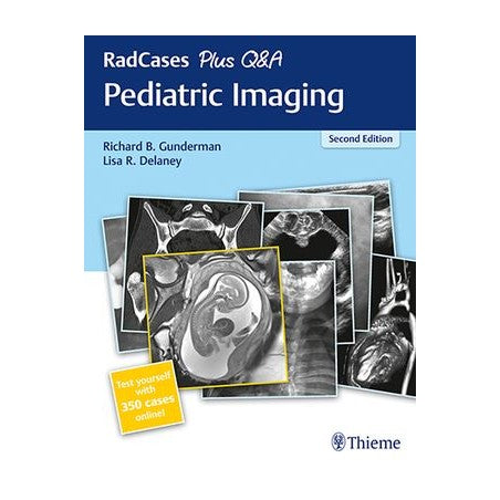 RadCases Plus Q&A Pediatric Imaging: 2/e