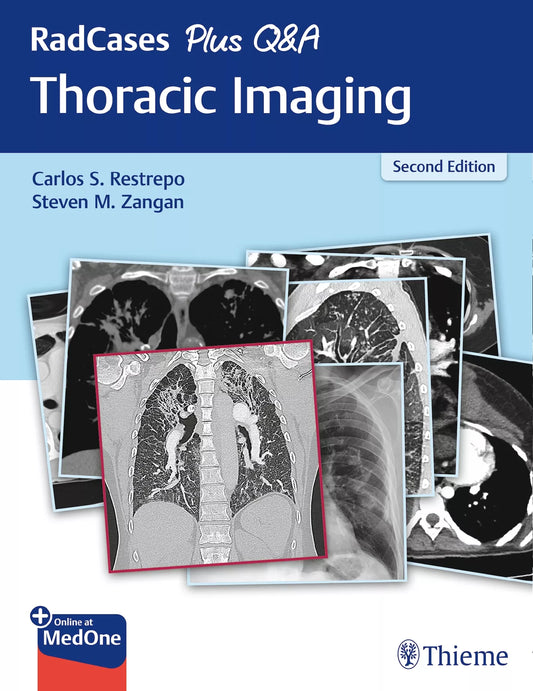 RADCASES PLUS Q AND A THORACIC IMAGING 2ND/2019