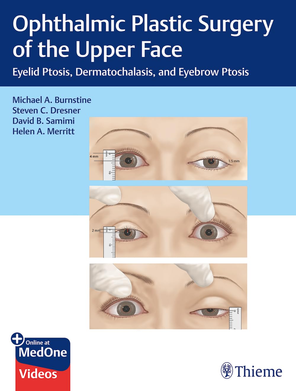 OPHTHALMIC PLASTIC SURGERY OF THE UPPER FACR - MICHAEL BURNSTINE