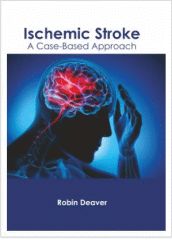 ISCHEMIC STROKE A CASE BASED APPROACH 1E/2021