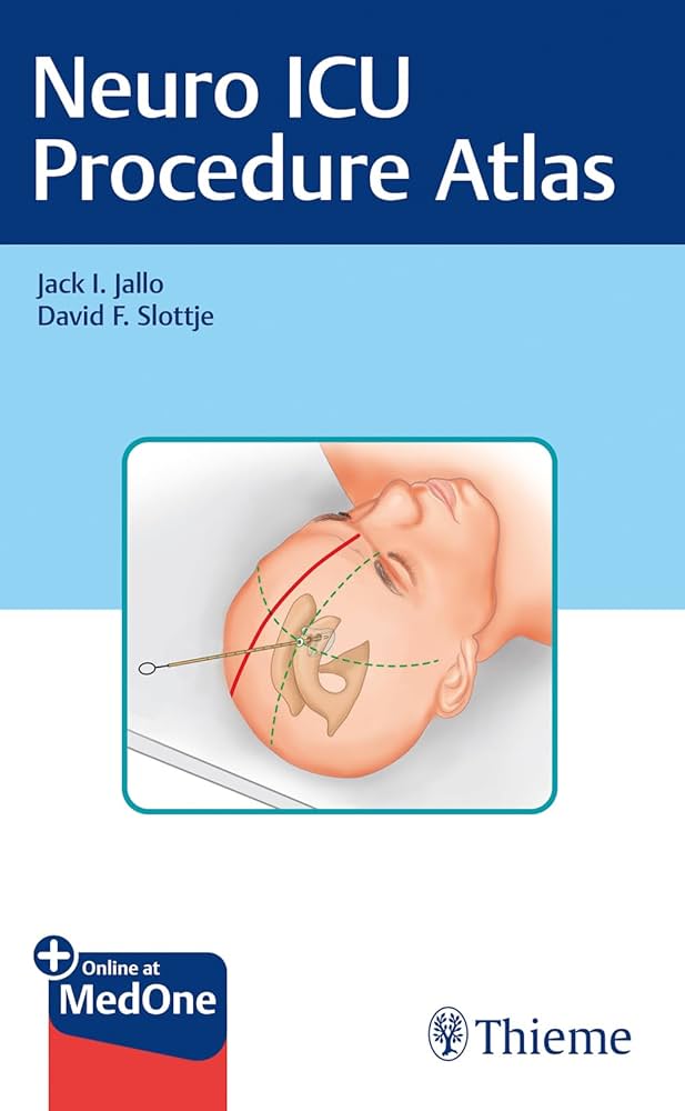 EVIDENCE BASED MANAGEMENT OF EPILEPSY 1E/2011