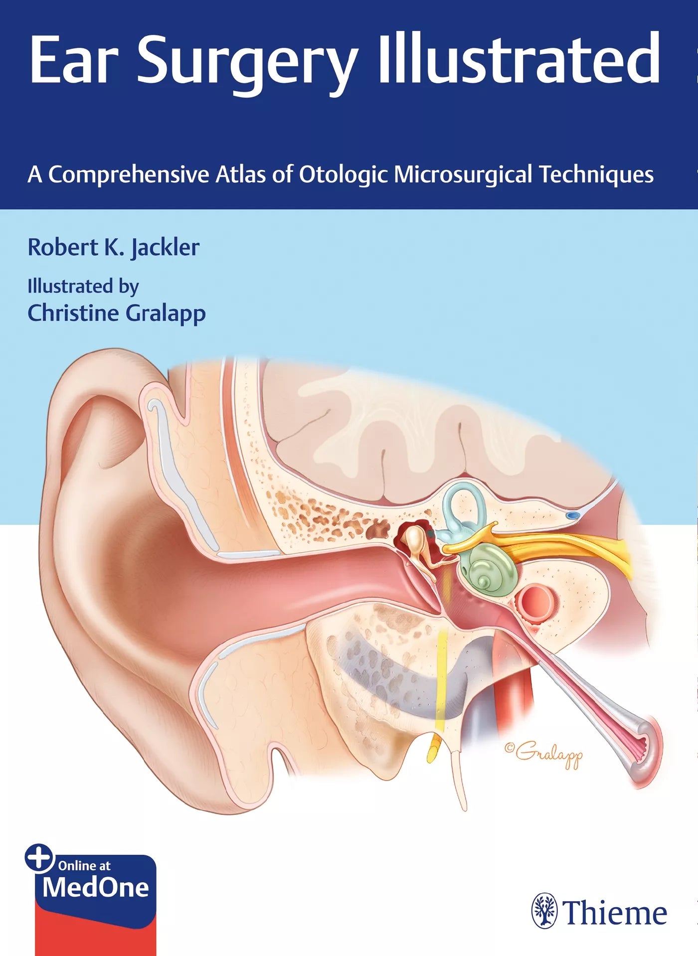 EAR SURGERY ILLUSTRATED A COMPREHENSIVE ATLAS OF OTOLOGIC MICROSURGICAL TECHNIQUES 1E/2019