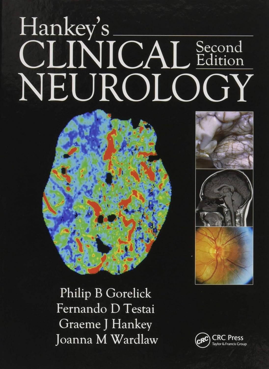 HANKEYS CLINICAL NEUROLOGY 2E/2014