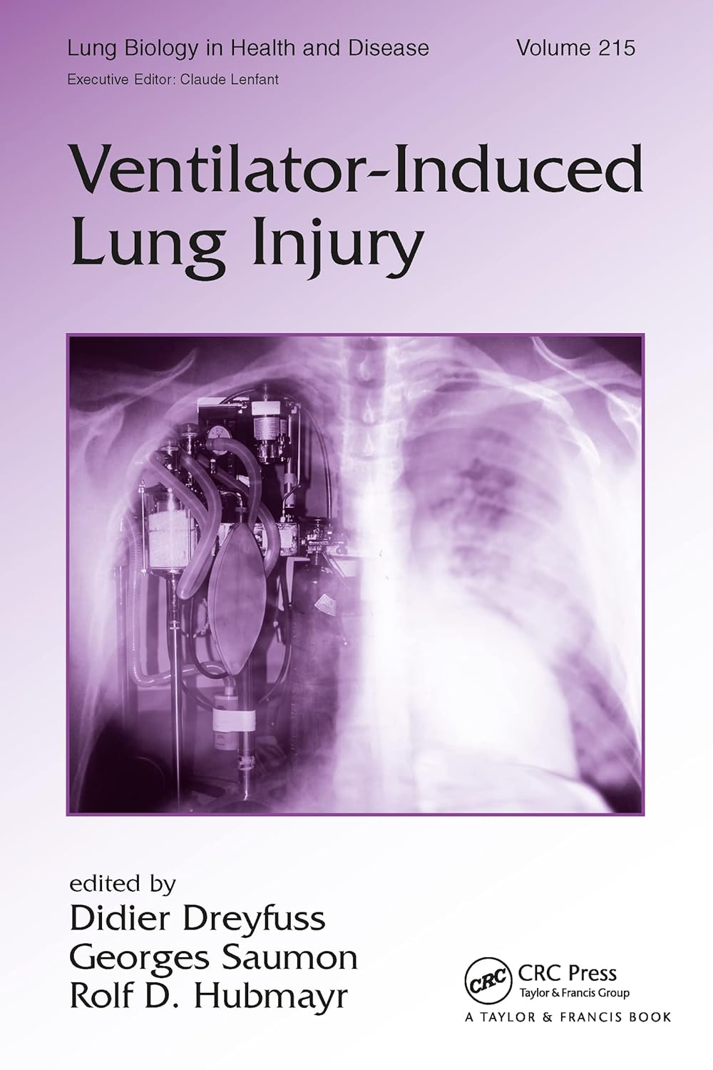 VENTILATOR INDUCED LUNG INJURIES VOL 215/2006 - DIDIER DREYFUSS