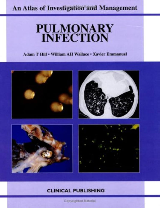 AN ATLAS OF INVESTIGATION AND MANAGEMENT PULMONARY INFECTION 1E/2005