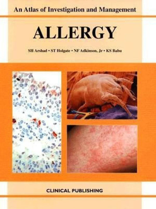 AN ATLAS OF INVESTIGATION AND MANAGEMENT ALLERGY 1E/2005