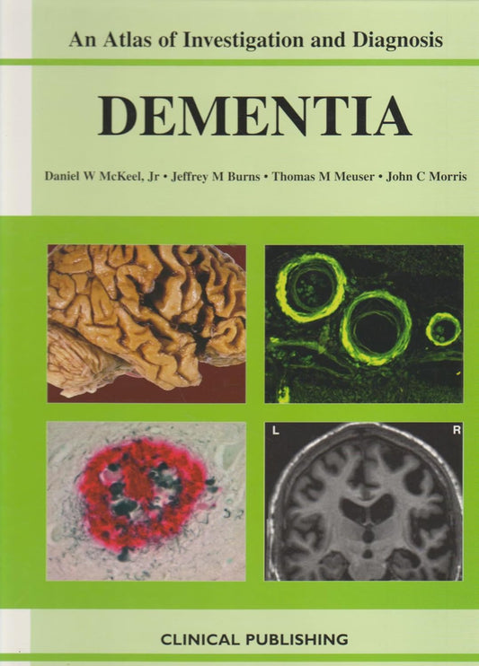 AN ATLAS OF INVESTIGATION AND DIAGNOSIS DEMENTIA 1E/2007