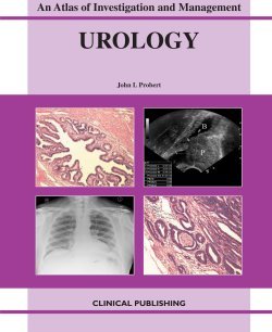 AN ATLAS OF INVESTIGATION AND DIAGNOSIS UROLOGY 1E/2009