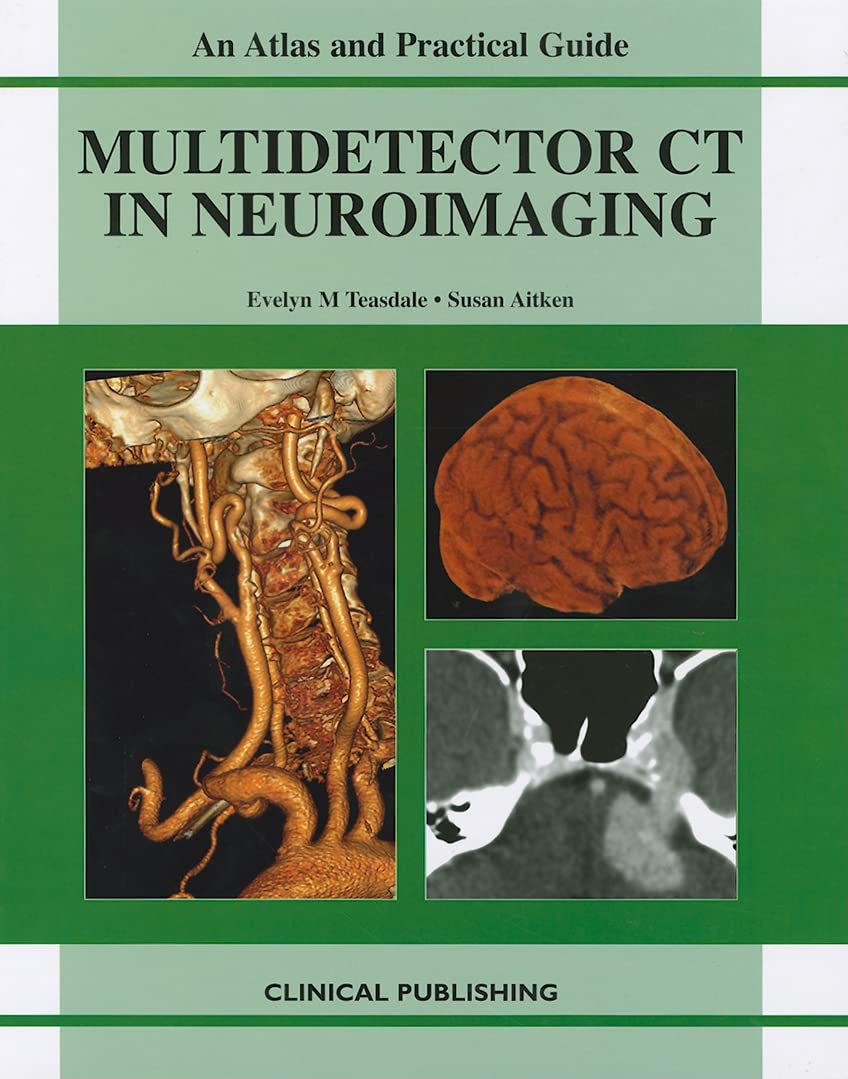 AN ATLAS AND PRACTICAL GUIDE MULTIDETECTOR CT IN NEUROIMAGING 1E/2009