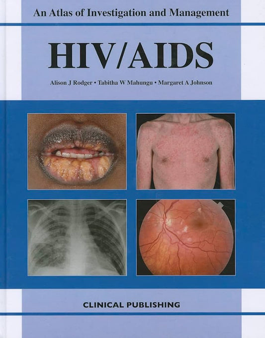 AN ATLAS OF INVESTIGATION AND MANAGEMENT HIV/AIDS 1E/2011