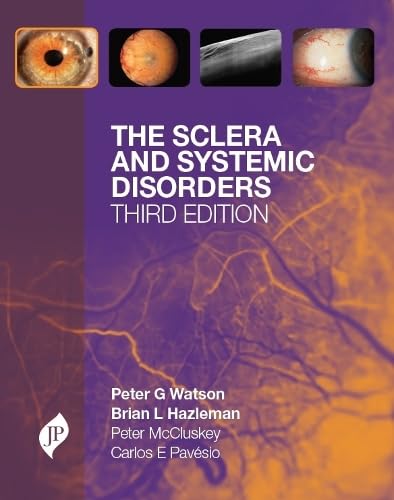 THE SCLERA AND SYSTEMIC DISORDERS 3RD/2012 - PETER G WATSON