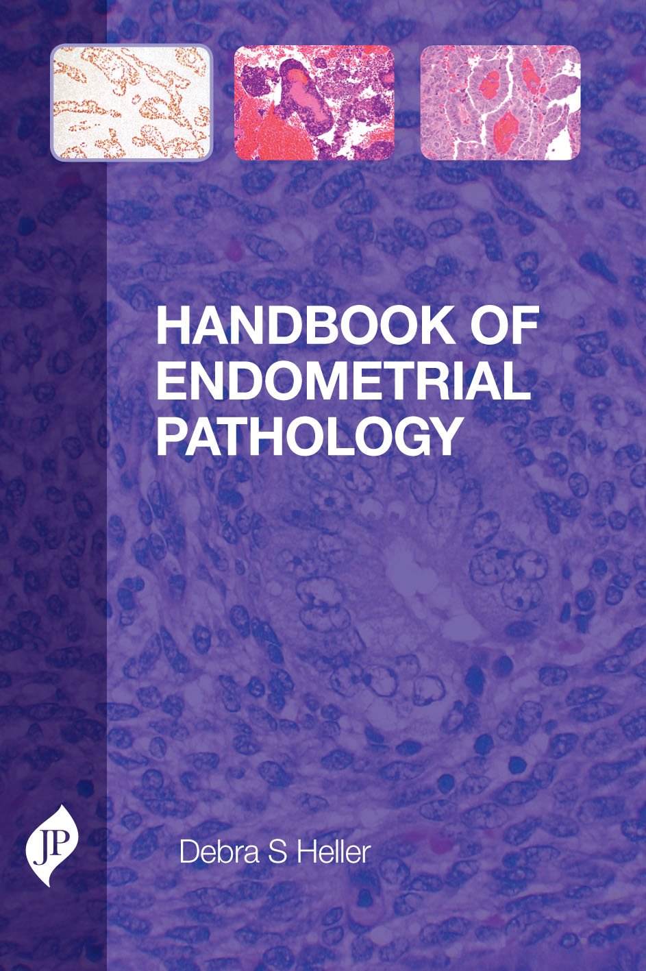 HANDBOOK OF ENDOMETRIAL PATHOLOGY 1ST/2012 - DEBRA S HELLER