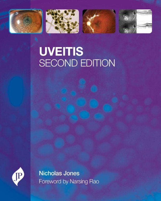 UVEITIS WITH CD-ROM 2ND/2013 - NICHOLAS JONES