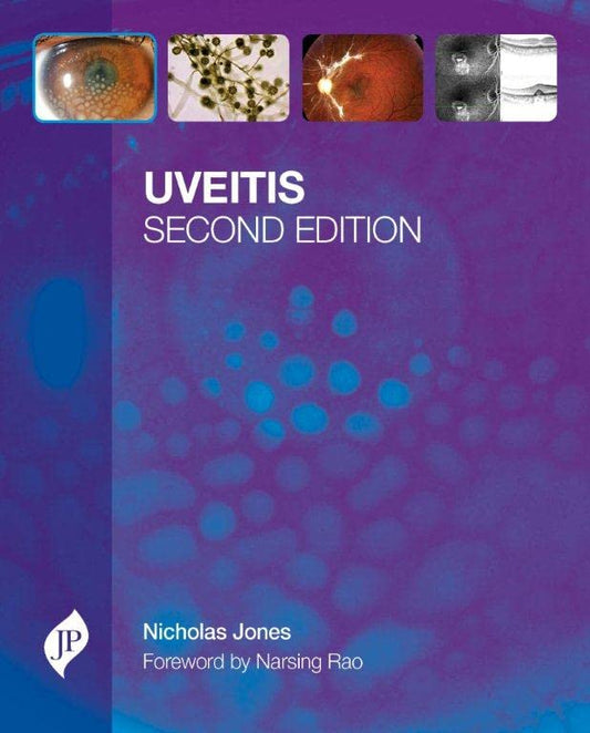UVEITIS WITH CD-ROM 2ND/2013 - NICHOLAS JONES