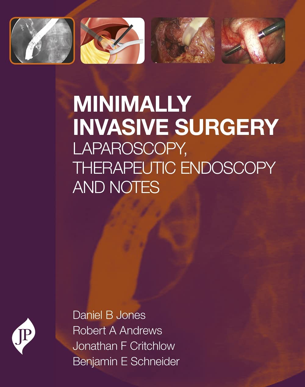 MINIMALLY INVASIVE SURGERY LAPAROSCOPY,THERAPEUTIC ENDOSCOPY AND NOTES 1ST/2015 - DANIEL B JONES