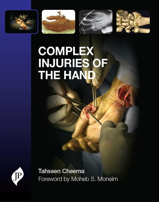 COMPLEX INJURIES OF THE HAND 1ST/2014 - TAHSEEN A CHEEMA