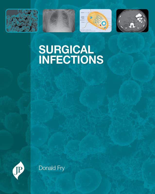SURGICAL INFECTIONS 1ST/2013 - DONALD E FRY