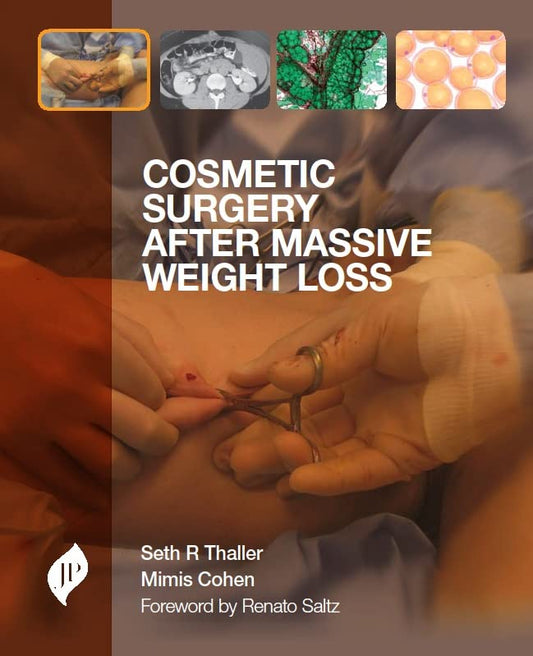 COSMETIC SURGERY AFTER MASSIVE WEIGHT LOSS 1ST/2013 - SETH R THALLER