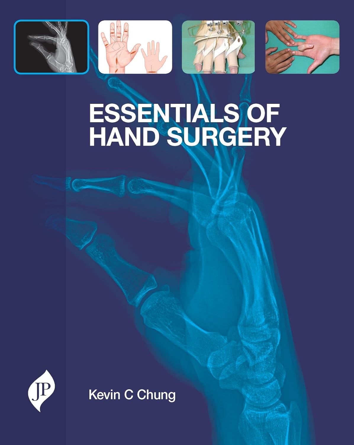 ESSENTIALS OF HAND SURGERY 1ST/2015 - KEVIN C CHUNG