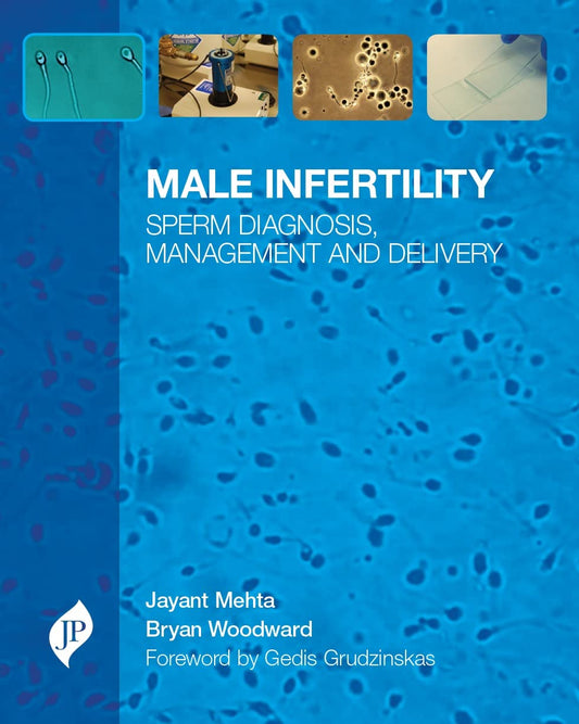 MALE INFERTILITY SPERM DIAGNOSIS MANAGEMENT AND DELIVERY 1ST/2014 - JAYANT MEHTA