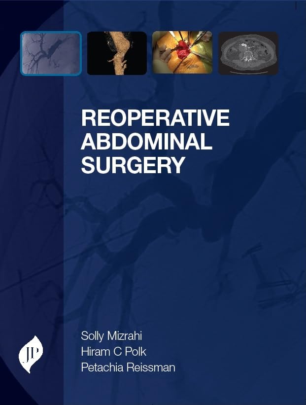REOPERATIVE ABDOMINAL SURGERY 1ST/2014 - SOLLY MIZRAHI