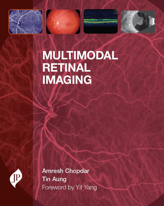 MULTIMODAL RETINAL IMAGING 1ST/2014 - AMRESH CHOPDAR