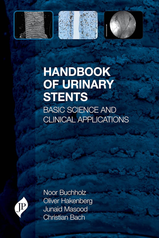 HANDBOOK OF URINARY STENTS BASIC SCIENCE AND CLINICAL APPLICATIONS 1ST/2016 - NOOR BUCHHOLZ