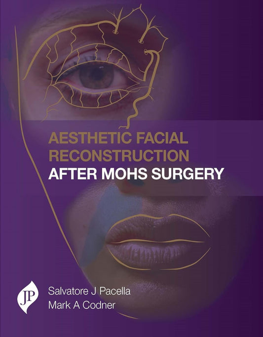 AESTHETIC FACIAL RECONSTRUCTION AFTER MOHS SURGERY 1ST/2016 - SALVATORE PACELLA, MARK A CODNER