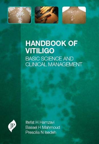 HANDBOOK OF VITILIGO BASIC SCIENCE AND CLINICAL MANAGEMENT 1ST/2016 - ILTEFAT H HAMZAVI