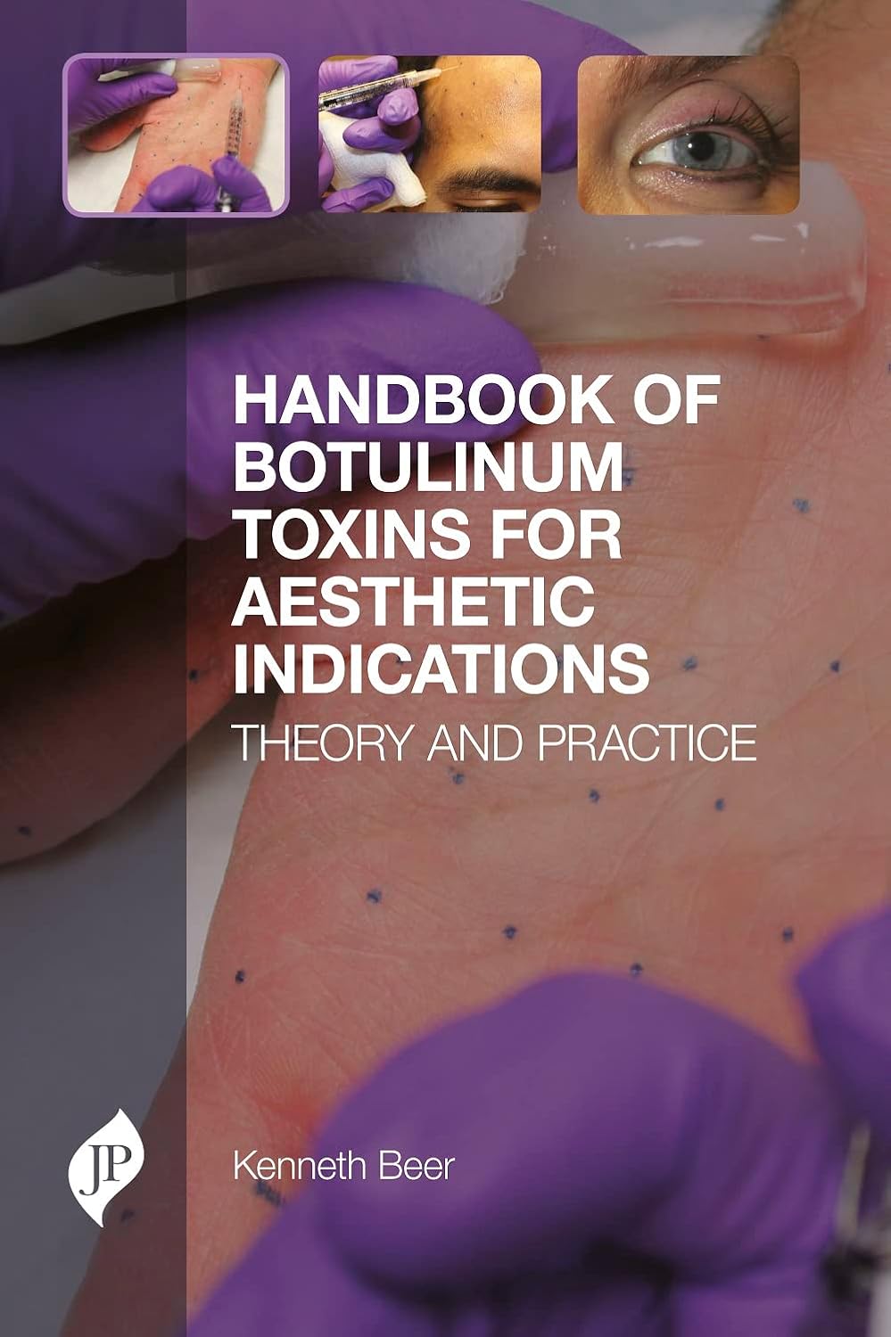 HANDBOOK OF BOTULINUM TOXINS FOR AESTHETIC INDICATIONS THEORY AND PRACTICE 1ST/2016 - KENNETH R BEER