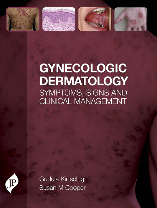 GYNECOLOGIC DERMATOLOGY SYMPTOMS, SIGNS AND CLINICAL MANAGEMENT 1ST/2016 - GUDULA KIRTSCHING