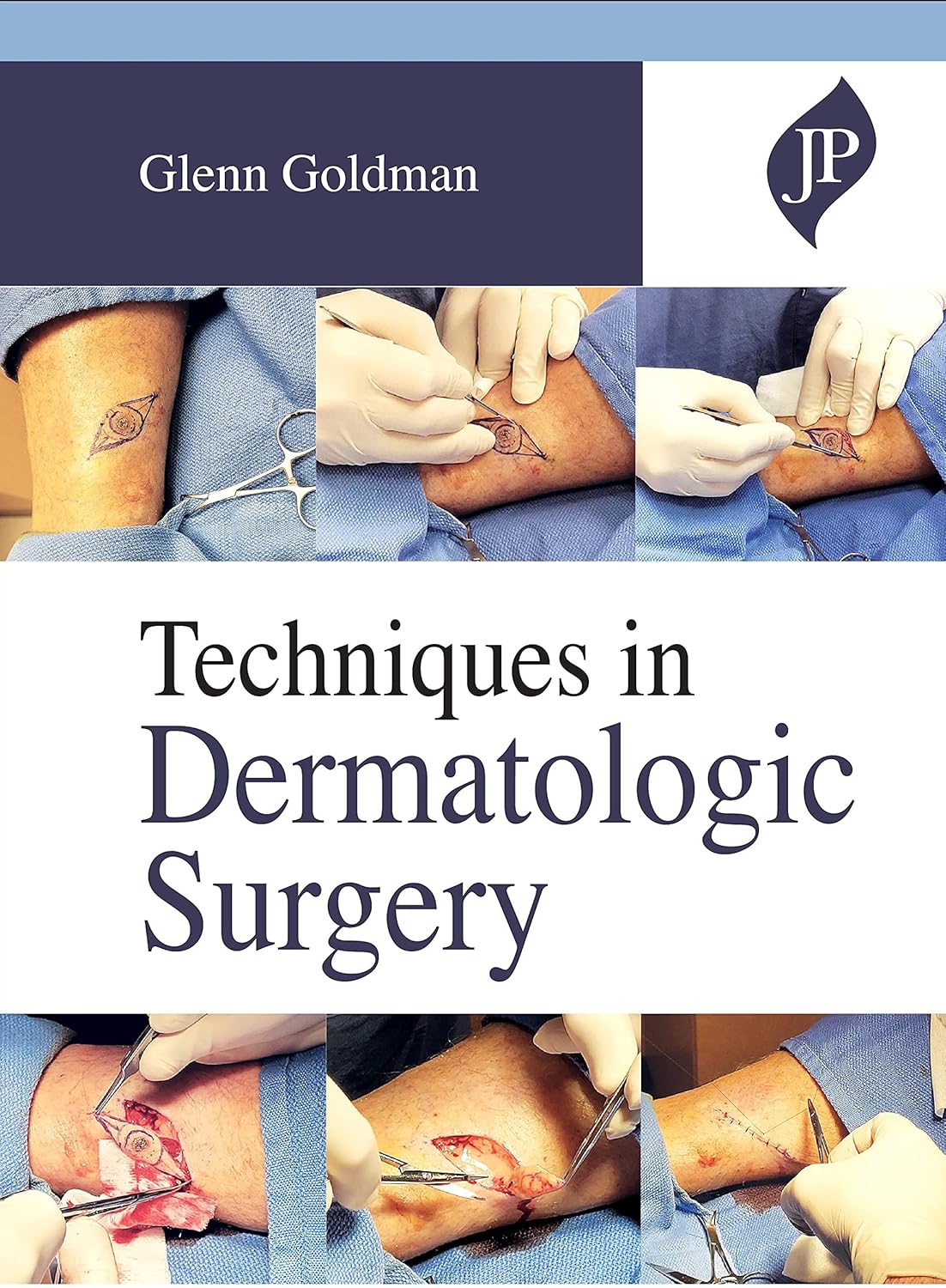 TECHNIQUES IN DERMATOLOGIC SURGERY 1ST/2021 - GLENN GOLDMAN