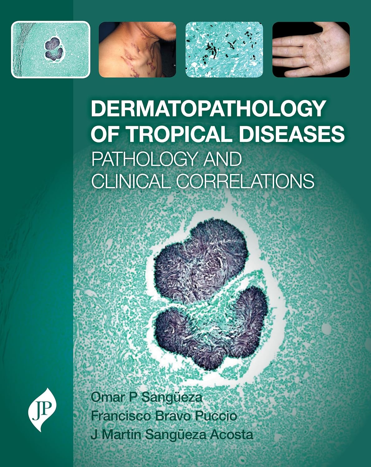 DERMATOPATHOLOGY OF TROPICAL DISEASES PATHOLOGY AND CLINICAL CORRELATIONS 1ST/2017 - OMAR P SANGUEZA
