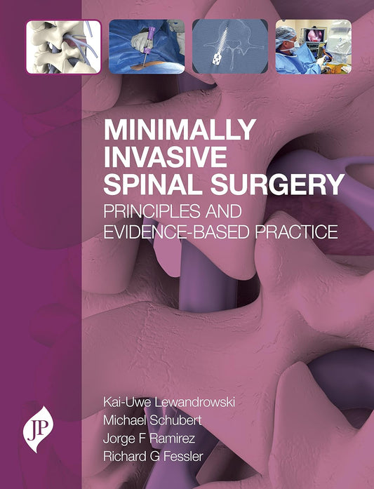 MINIMALLY INVASIVE SPINAL SURGERY PRINCIPLES AND EVIDENCE-BASED PRACTICE 1ST/2018 - KAI-UWE LEWANDROWSKI