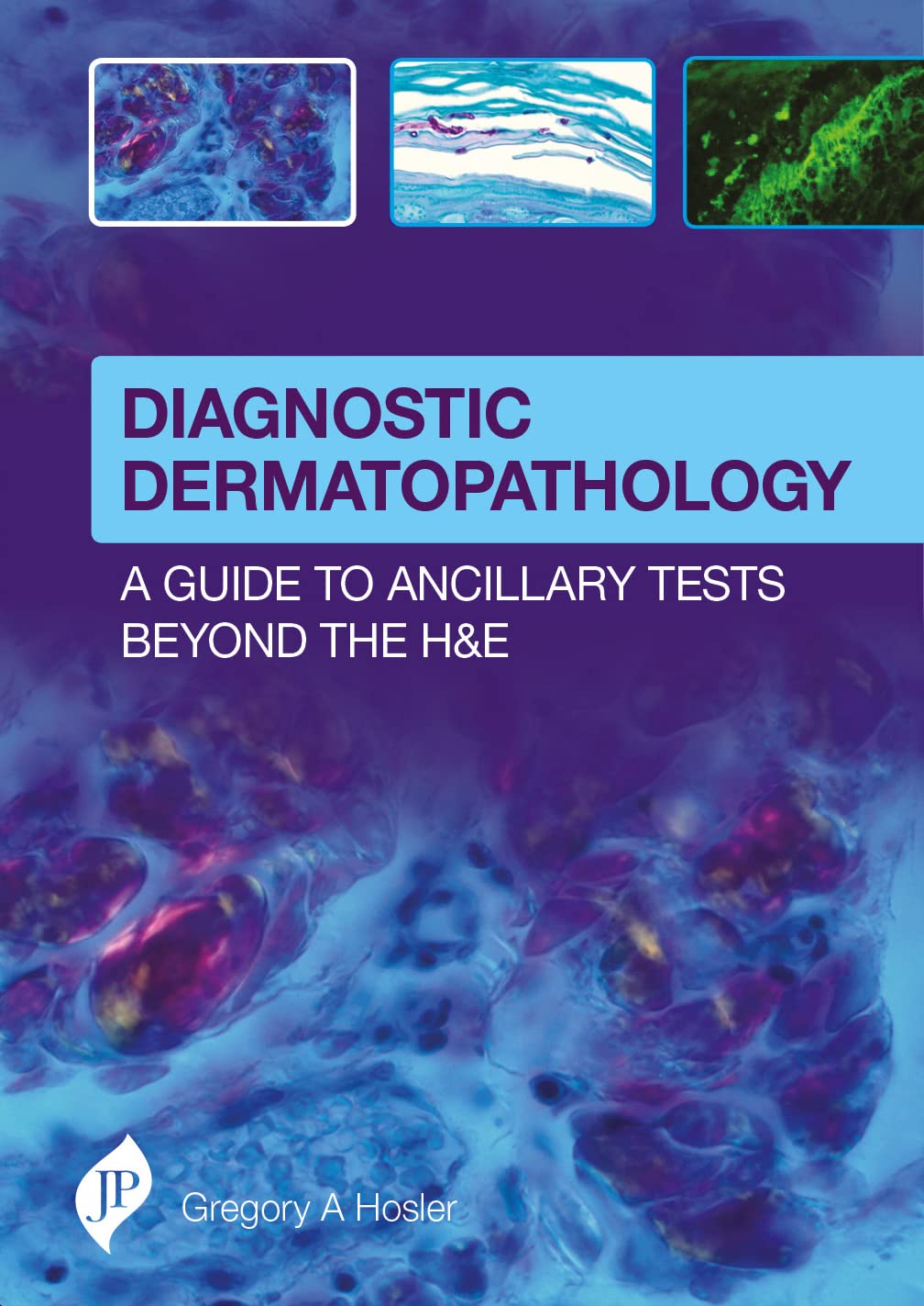 DIAGNOSTIC DERMATOPATHOLOGY:A GUIDE TO ANCILLARY TESTS BEYOND THE H&E 1ST/2017 - GREGORY A HOSLER