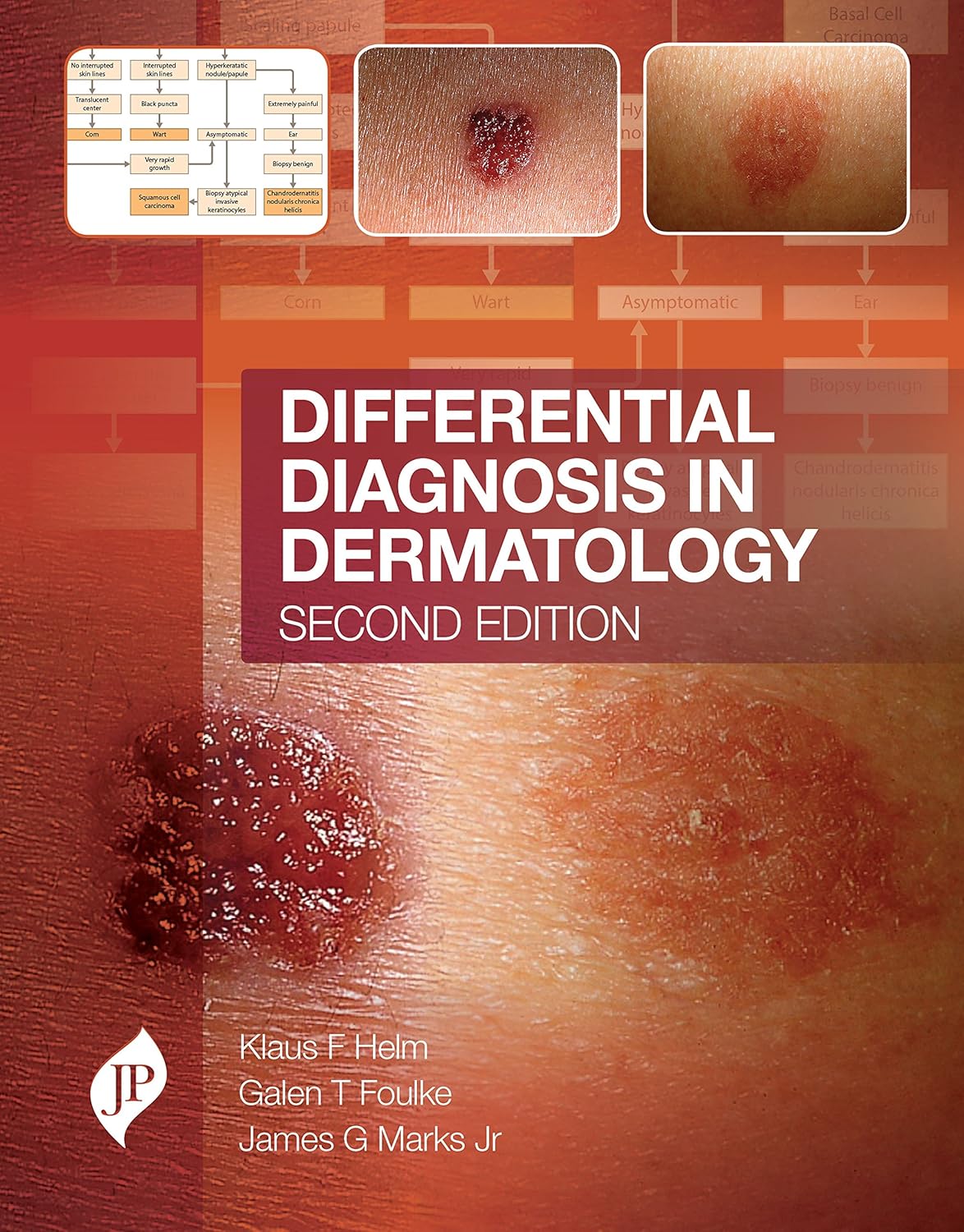 DIFFERENTIAL DIAGNOSIS IN DERMATOLOGY 2ND/2018 - KLAUS F.HELM