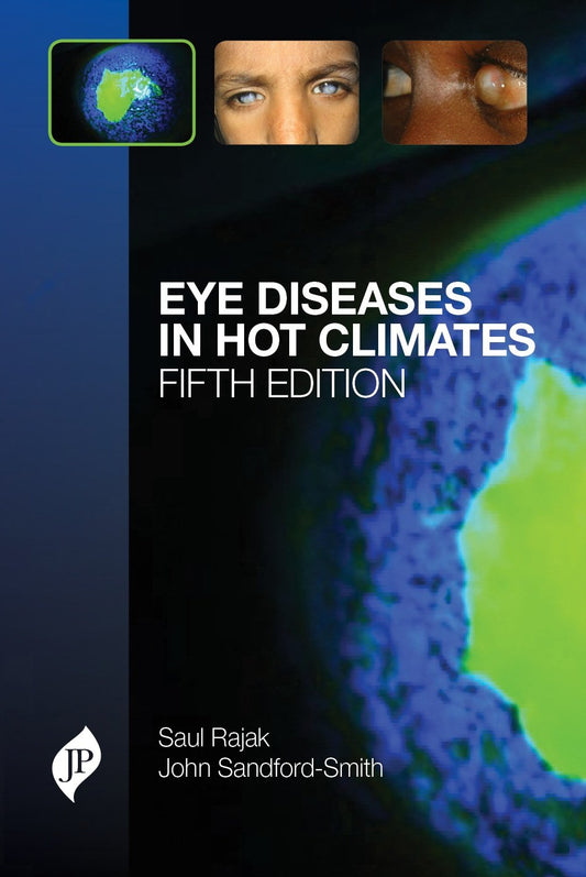 EYE DISEASES IN HOT CLIMATES 5TH/2015 - SAUL RAJAK