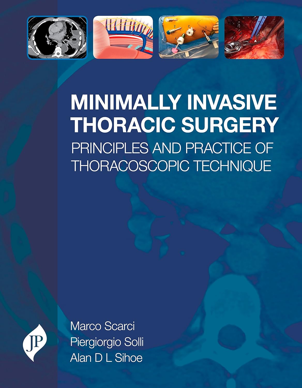 MINIMALLY INVASIVE THORACIC SURGERY PRINCIPLES AND PRACTICE OF THORACOSCOPIC TECHNIQUE 1ST/2018 - MARCO SCARCI