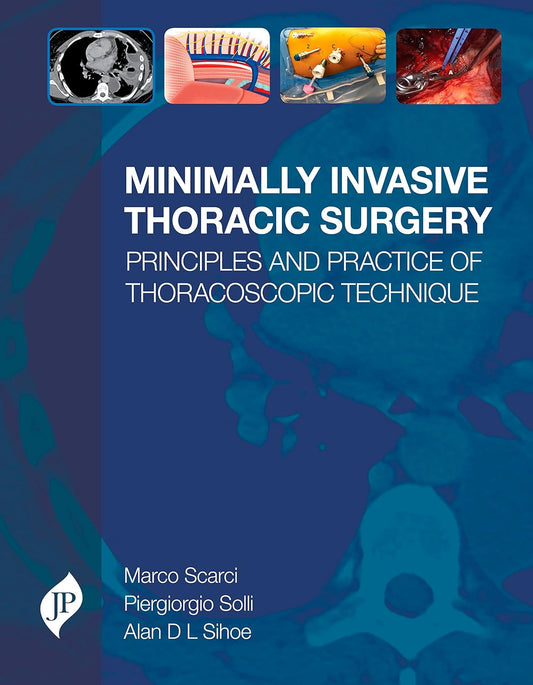 MINIMALLY INVASIVE THORACIC SURGERY PRINCIPLES AND PRACTICE OF THORACOSCOPIC TECHNIQUE 1ST/2018 - MARCO SCARCI