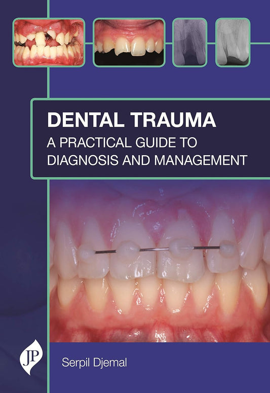 DENTAL TRAUMA: A PRACTICAL GUIDE TO DIAGNOSIS AND MANAGEMENT 1ST/2021 - SERPIL DJEMAL
