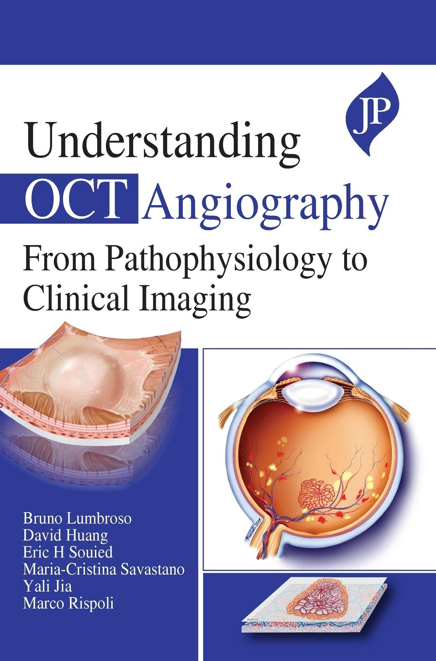 UNDERSTANDING OCT ANGIOGRAPHY FROM PATHOPHYSIOLOGY TO CLINICAL IMAGING 1ST/2020 - BRUNO LUMBROSO