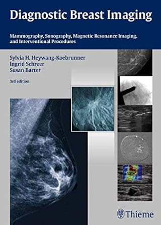 Diagnostic Breast Imaging: Mammography, Sonography, Magnetic Resonance Imaging and Interventional Procedures