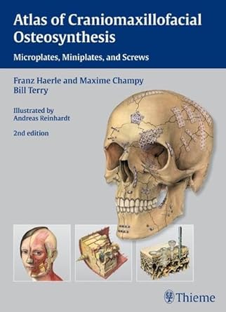 Atlas of Craniomaxillofacial Osteosynthesis: Microplates, Miniplates and Screws 1ST/2009