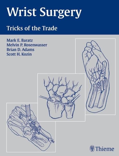 WRIST SURGERY TRICKS OF THE TRADE 1ST/2006 - MARK BARATZ